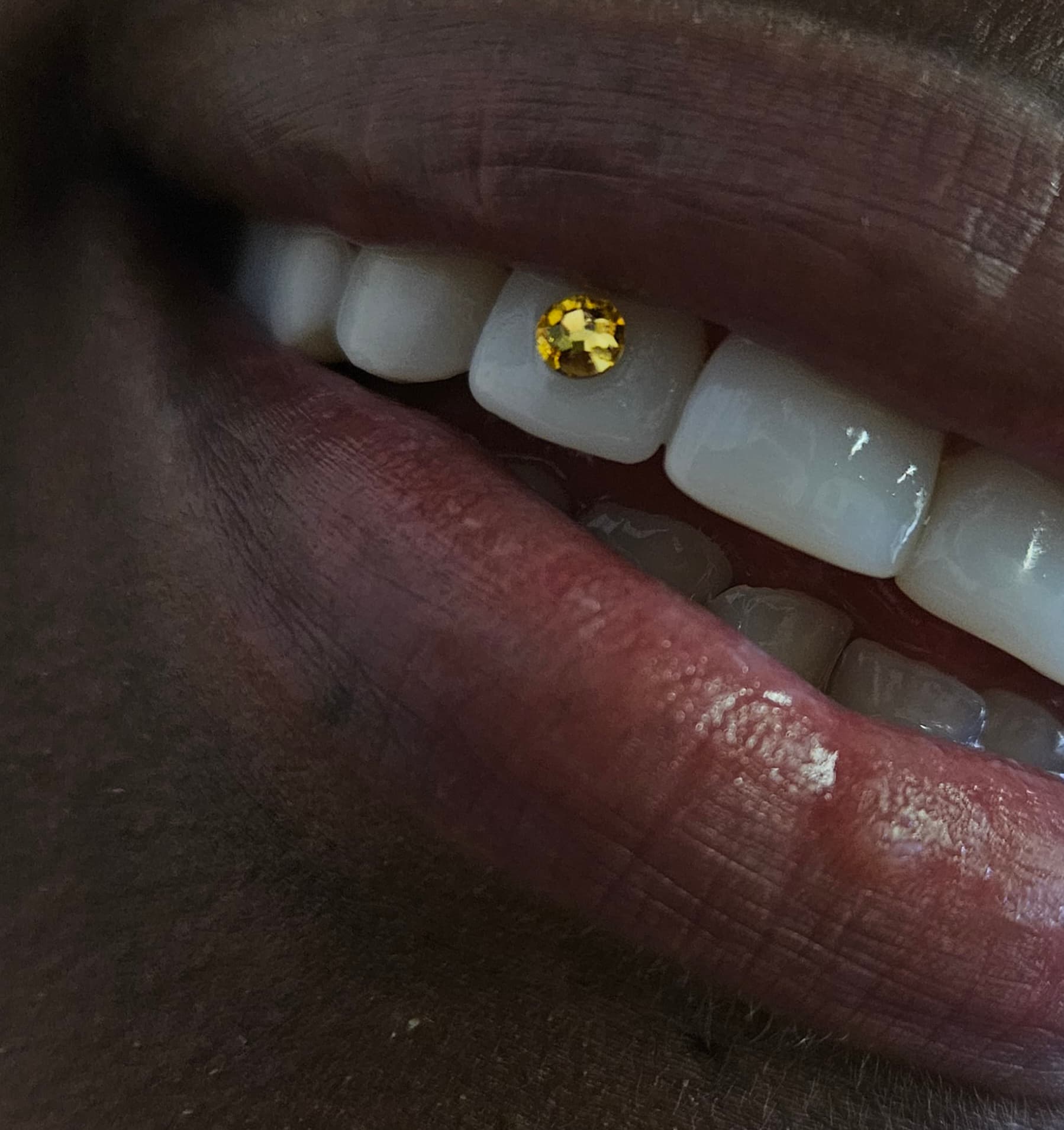 Enkel kristal / Basic tooth gem