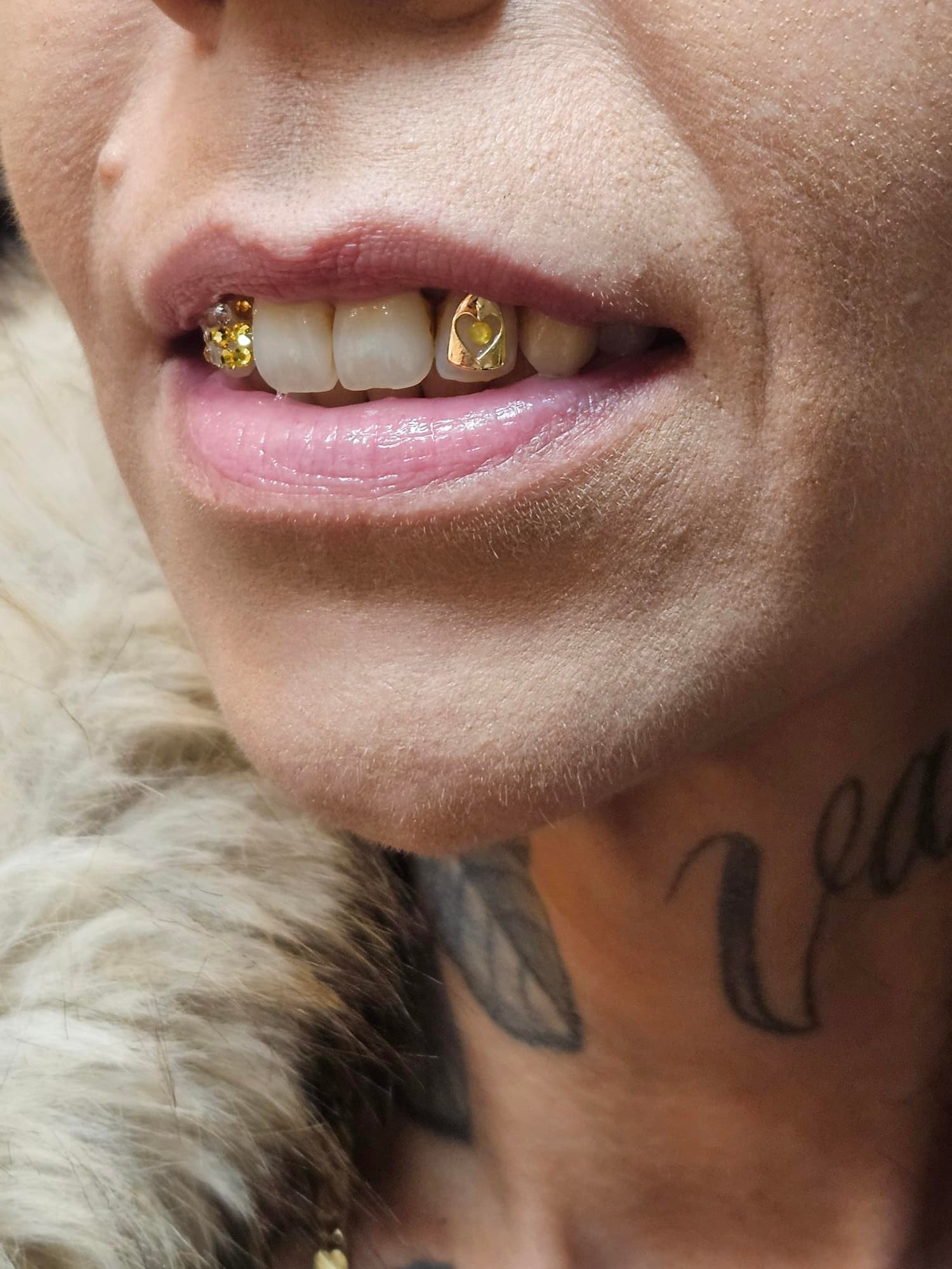 Goud en Wit Goud | 18K